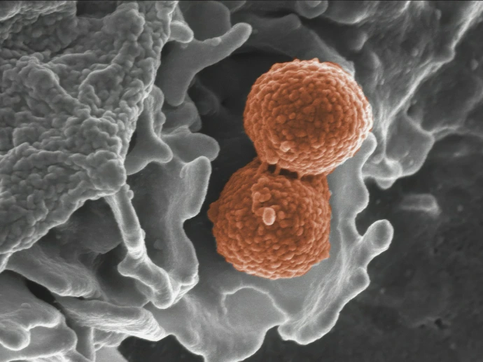 a close up of a blood vessel with two blood vessels
