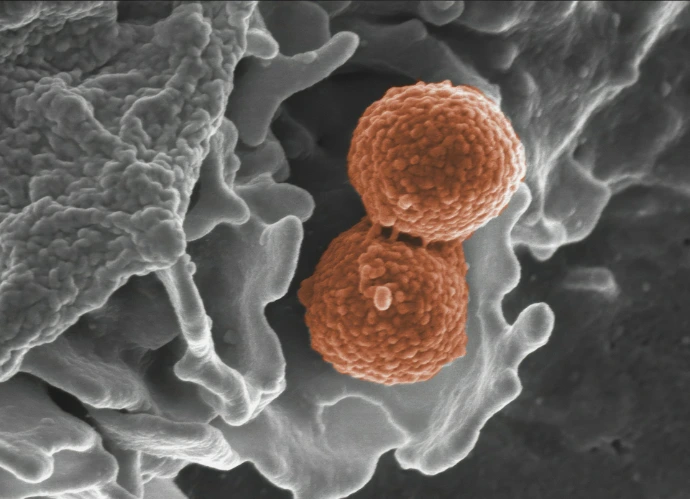 a close up of a blood vessel with two blood vessels